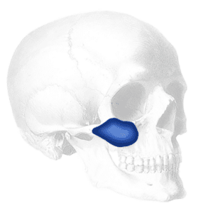 combined malar and submalar cheek implant; types of cheek implants